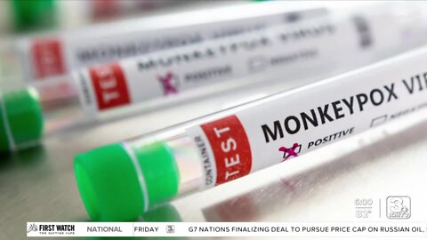First Monkeypox case in Douglas County detected; authorities say 'not easily transmissible'