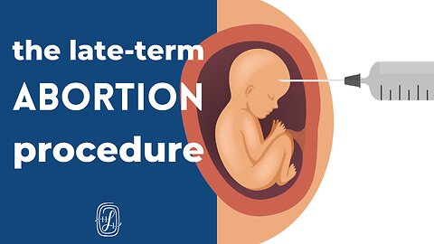 How Does a 3rd Trimester Abortion Work?