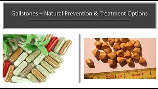 Gallstones - Natural Prevention & Treatment Options