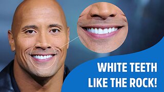 Get a Hollywood Smile with These Surprising Teeth Whitening Hacks - Whiter Smile!