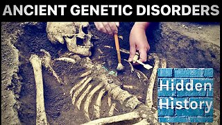 Earliest cases of genetic disorders discovered in ancient DNA