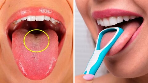 Scrape Your Tongue Every Morning For These Amazing Benefits