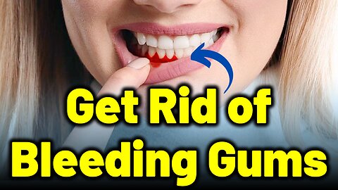 How to Treat Bleeding Gums : Causes and Solutions | Expert Advise | Dr. Bharadwaz | Dr. Gopikrishna