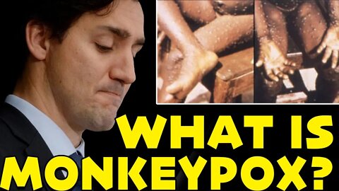 What Is Monkey Pox?