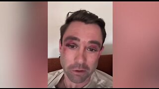 Fox Weatherman BEATEN In NYC Subway