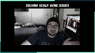 Acne Issues