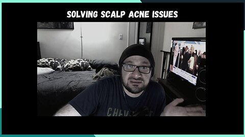 Acne Issues