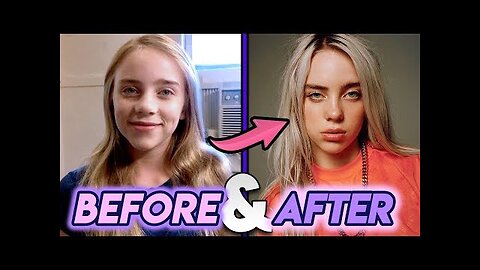 Billie Eilish | Before and After Transformations | Glow Up
