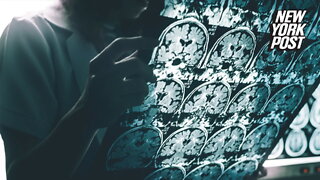 MIT scientists discover 'remarkable' way to reverse Alzheimer's disease