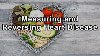 Measuring and Reversing Heart Disease: The Role of Plant-Based Nutrition - Joel K. Kahn M.D.