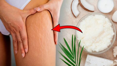 Get Rid of Stretch Marks and Cellulite With This Sugar Scrub Recipe