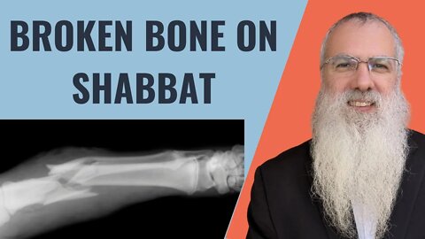 Mishna Shabbat Chapter 22 Mishnah 6 Broken bone on Shabbat