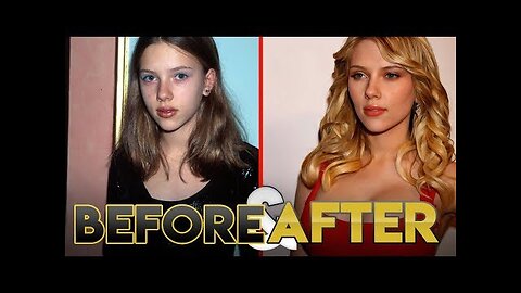 SCARLETT JOHANSSON | Before & After Transformation | Plastic Surgery, Diet, Fitness & more