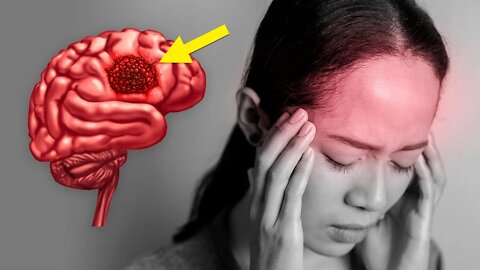 7 SINAIS DE ALERTA DE TUMOR CEREBRAL QUE VOCÊ DEVE CONHECER