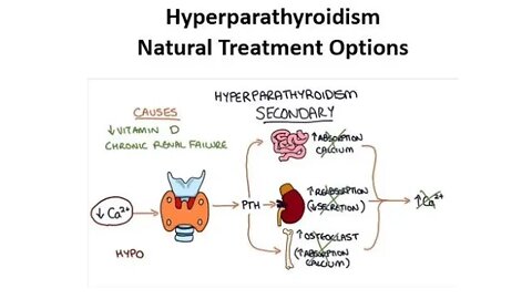Hyperparathyroidism - Natural Treatment Options