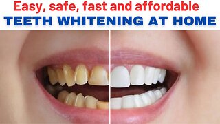 Whiten Your Teeth At Home