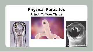 Parasites in Our Physical Body