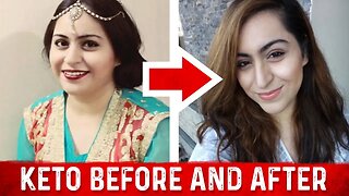 Before & After Intermittent Fasting & Keto Success – Dr. Berg Interview – Aysha Islam