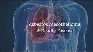 Remodeling and breaking building materials? Be aware of asbestos which might cause Mesothelioma