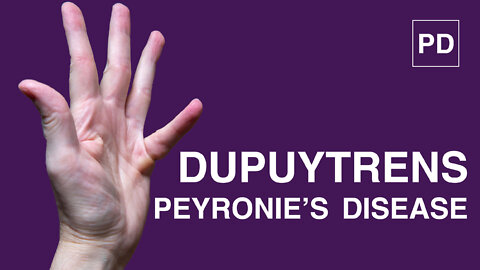 Dupuytren's Contracture and Peyronie's Disease | Dupuytren's Contracture Treatment | Mansmatters