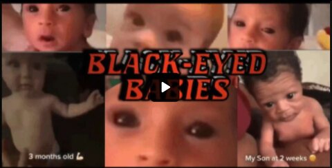 Black Eyed Babies~ The Offspring of the Vaccinated