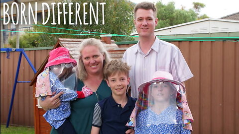 We Are Allergic To Sunlight | BORN DIFFERENT