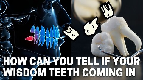 How do you know if your wisdom teeth are coming in