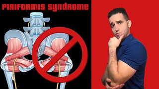 The Hidden Cause of Lower Back and Leg Pain: Piriformis Syndrome a.k.a. False Sciatica