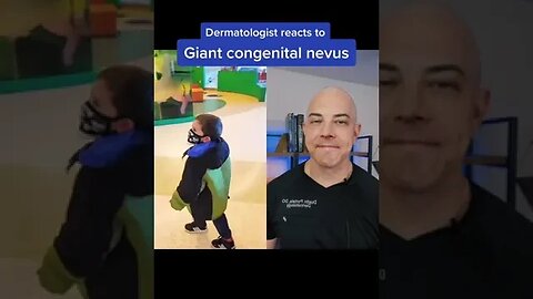 Doctor reacts to giant congenital nevus! #congenitalnevus #dermreacts #nevus