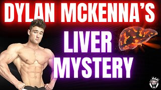 The Mystery of Dylan McKenna’s Liver