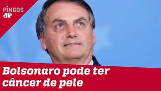 Bolsonaro pode ter câncer de pele