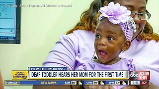 Deaf toddler gets cochlear implants, hears mom say 'I love you'