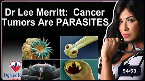 PARASITES: MEDICAL SYSTEM EXPOSED FOR HIDING REAL CAUSE OF DISEASE