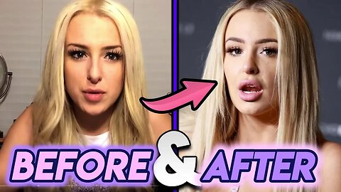 Tana Mongeau | Before and After | Plastic Surgery Transformation