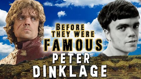 PETER DINKLAGE - Before They Were Famous
