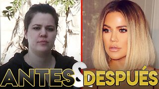 Khloe Kardashian | Transformación Antes y Después | Cirugías Estéticas