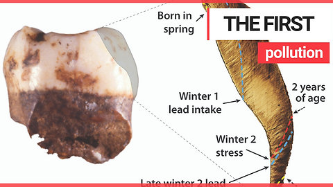 Lead poisoning found in teeth of Neanderthal children who lived 250,000 years ago