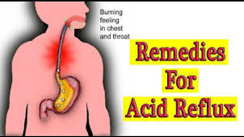 Miracle Remedy For: Diet and GERD Acid Reflux Heartburn