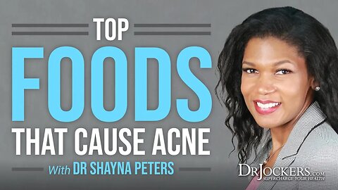 The Foods and Stressors That Trigger Acne and Skin Problems with Dr. Shayna Peter