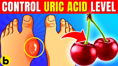 Control & Lower Your Uric Acid Levels With These 8 Tips