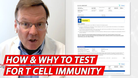 How and why to test for T cell Immunity