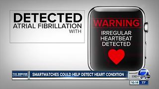 Study: Apple Watch may help doctors spot heart condition