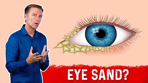 What Causes Crusty Eyes/ Eye Boogers? – Dr.Berg