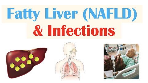 Non-Alcoholic Fatty Liver Disease & Infections | Immunity, Types of Infections