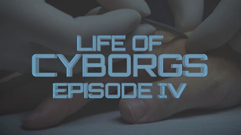 Life of Cyborgs: Watch how an implant is done