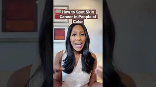 How to Spot SKIN CANCER in People of Color! 😯 #shorts