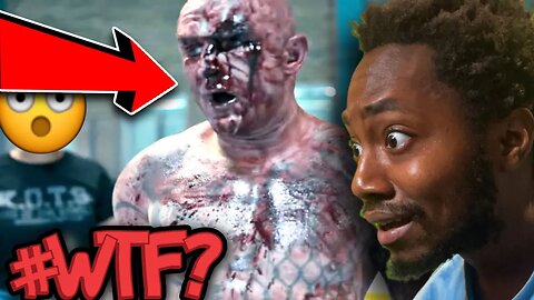 THIS DUDE LOST HIS WHOLE EYEBALL!! |KING OF THE STREETS REACTION|