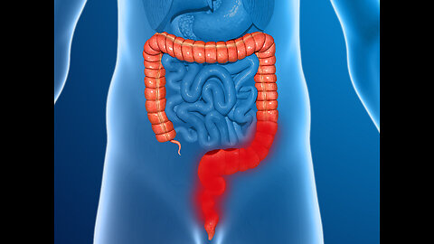 Three Ways To Keep The Colon Clean