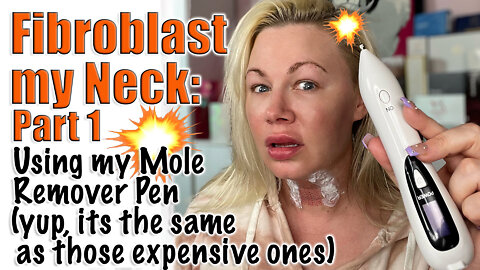 Fibroblast my Neck with Mole Pen : Part 1 | Code Jessica10 Saves you Money!