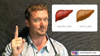 ❗ STOP These 5 Things to Reverse Fatty Liver (Update 2021) ❗